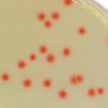 For the detection of those bacteria, traditional methods (TCBS) are long, require heavy workload and are not very sensitive. On the contrary, CHROMagar Vibrio medium helps to easily differentiate V.