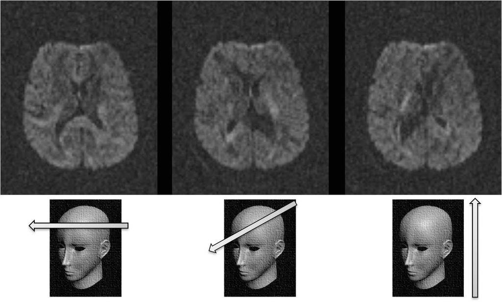 3 Neda Sepasian, Jan ten Thije Boonkkamp, Anna Vilanova Diffusion tensor imaging: brain pathway reconstruction NAW 5/6 nr.