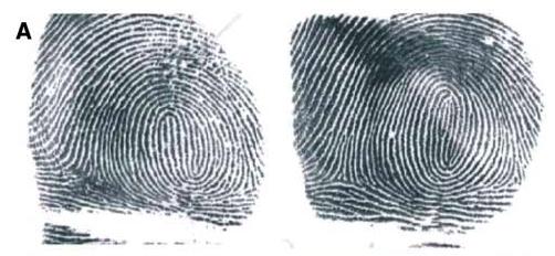 Stochastic Influences on Phenotype Fingerprints