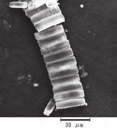 As can be seen here again, substantial amount of silver is observed on the surface of the diatoms.