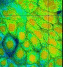 Microscopy: Multiphoton Fluorescence Microscopy