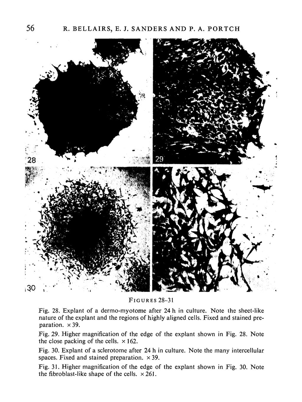 56 R. BELLAIRS, E. J. SANDERS AND P. A. PORTCH FIGURES 28-31 Fig. 28. Explant of a dermo-myotome after 24 h in culture.