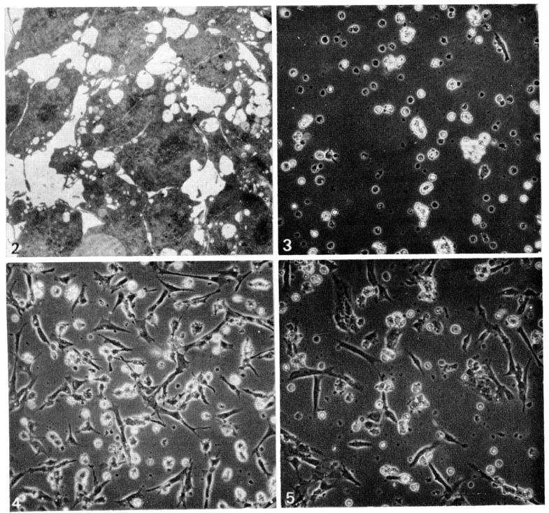 5 Fig. 3. Phase contrast photograph of cells from unsegmented mesoderm (stage-12 embryos) which had been dissociated and plated out on Falcon dishes.