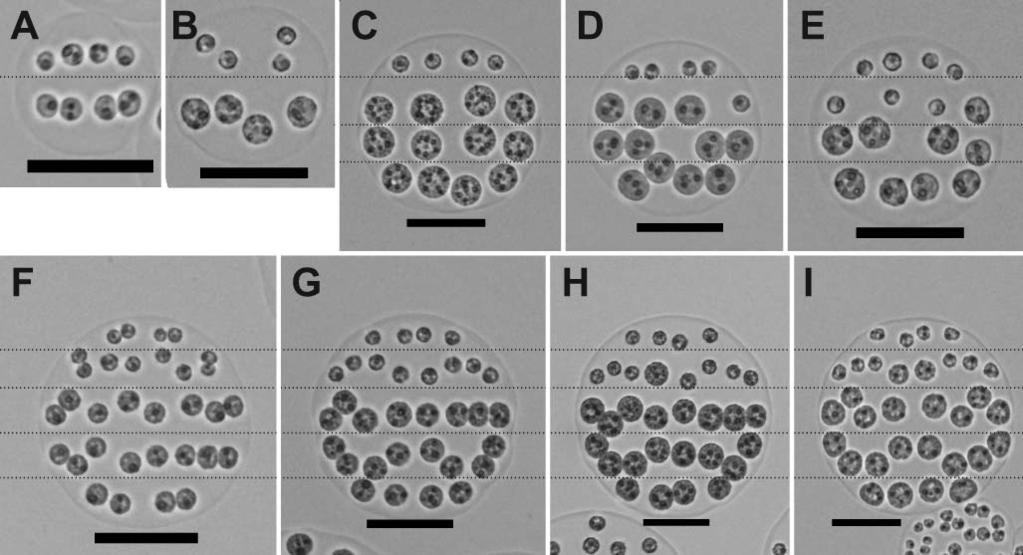 Fig. 4. Pleodorina starrii colonies showing tiered arrangements of cells (contrast-enhanced). Photographs have been scaled to emphasize the similarities; all scale bars are 50 µm.