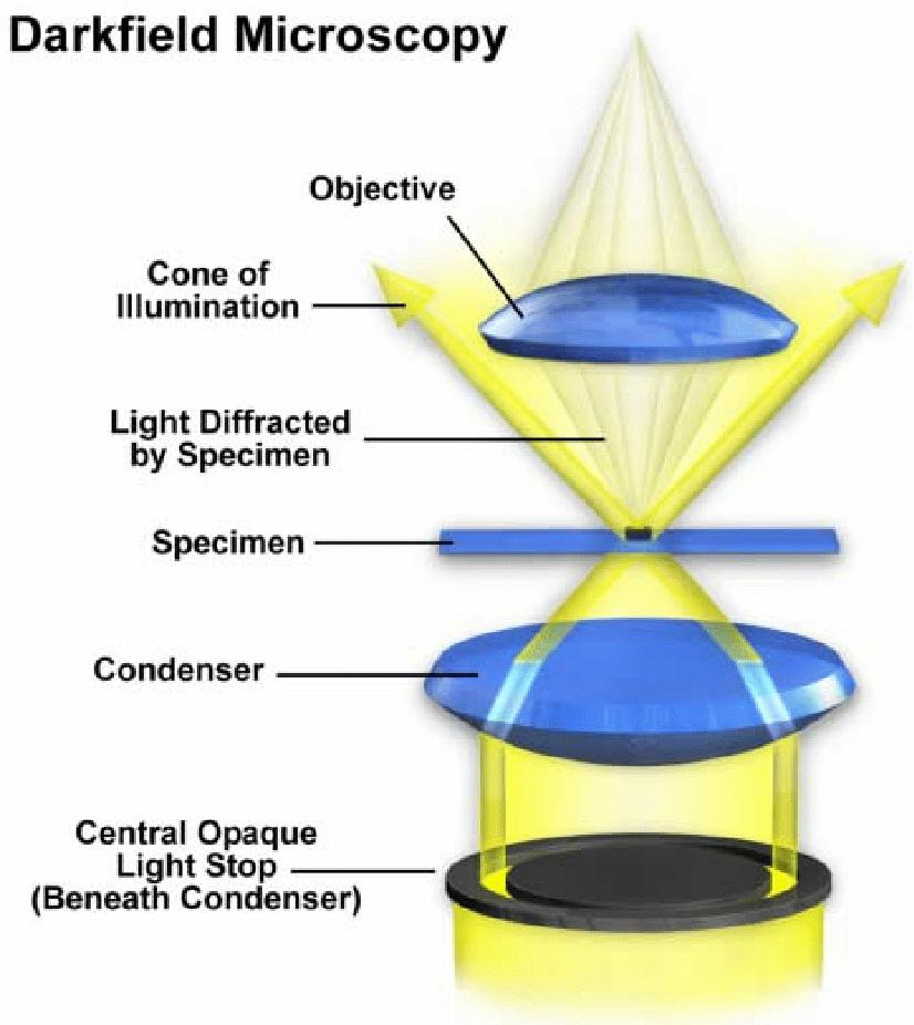 Optical Microscopy: Bright and Darkfield brightfield: conventional illumination with direct observation of light