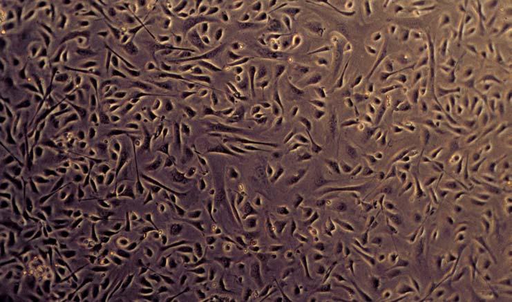 Cell adhesion tests II cells: endothelial cells from a