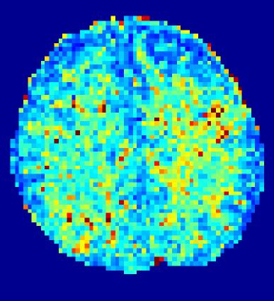 Tensorial Spherical Polar Fourier Diffusion MRI with Optimal Dictionary Learning 7 Number of Nonzero Coefficients 18 16 14 12 1 8 6 4 2 SPF, single tensor DL-SPF, single tensor TSPF,