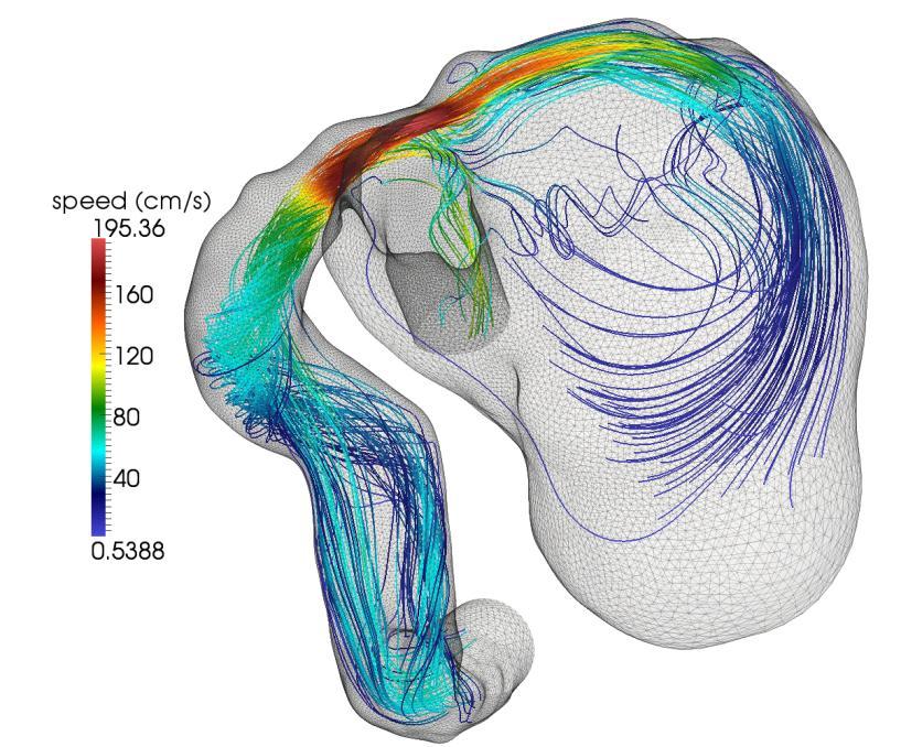 Strong Scalability Test: Simulation of blood flow in a giant aneurysm on the internal carotid artery. Benchmark proposed in the CFD Challenge Workshop at ASME 2012.