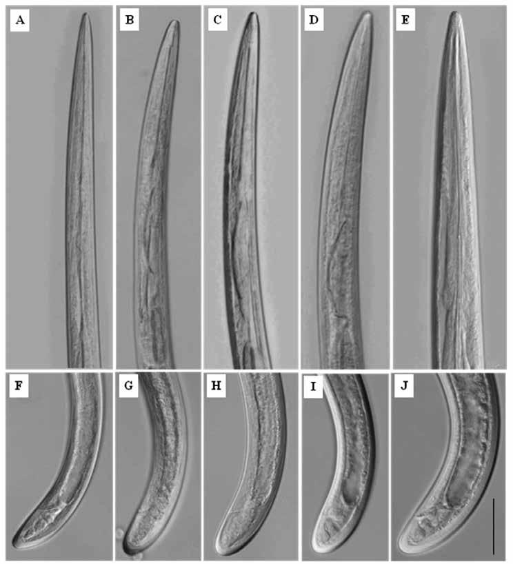 Longidorus hangzhouensis Zheng et al., 2001 (Nematoda: Longidoridae) from China.. Fig. 1. Longidorus hangzhouensis Zheng, Peng, Robbins & Brown, 2001, juvenile stages to adult. A-D.