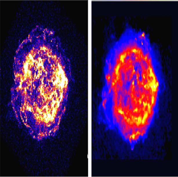 External Shock Cassiopea A Chandra 2001 & VLA