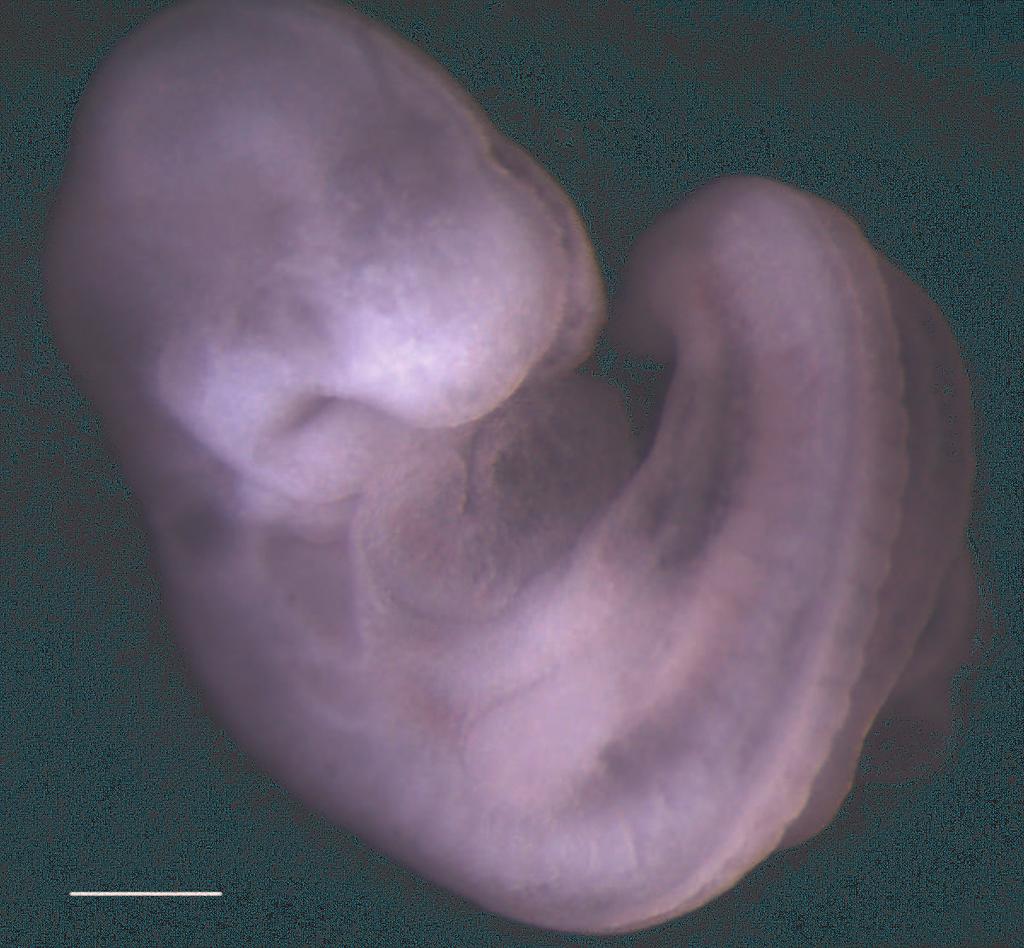 CHAPTER 1. INTRODUCTION 2 Figure 1.1: A mouse embryo at 9.5 days post fertilisation. The scale bar indicates approximately 5 microns. Image courtesy of P. M. Kulesa, Stowers Institute.