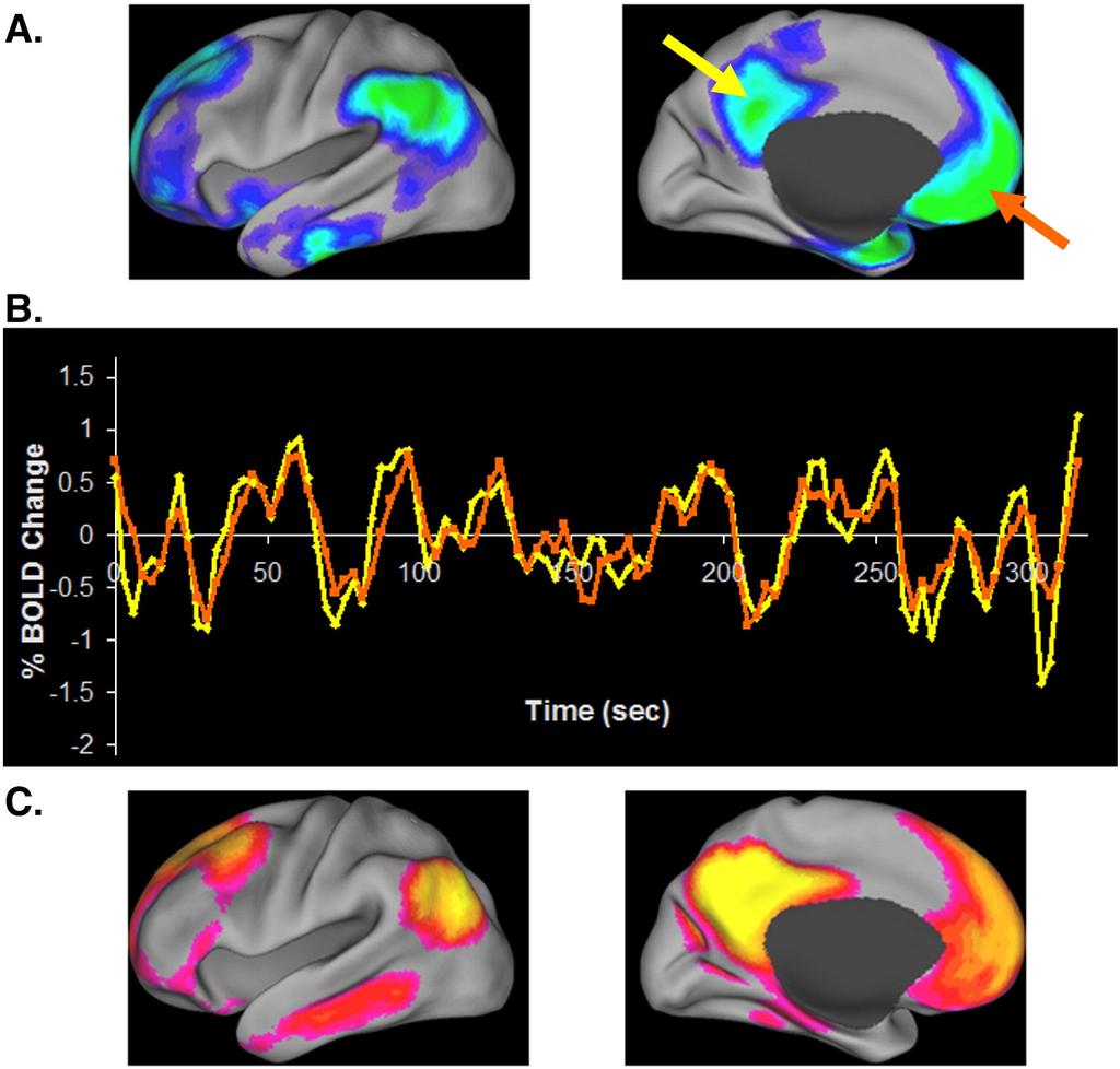 The brain at rest Independent Component Analysis of fmri at rest Issues in ICA of EEG/MEG Different sparsities Fourier-ICA Spatial ICA Is anything happening in the brain at rest?