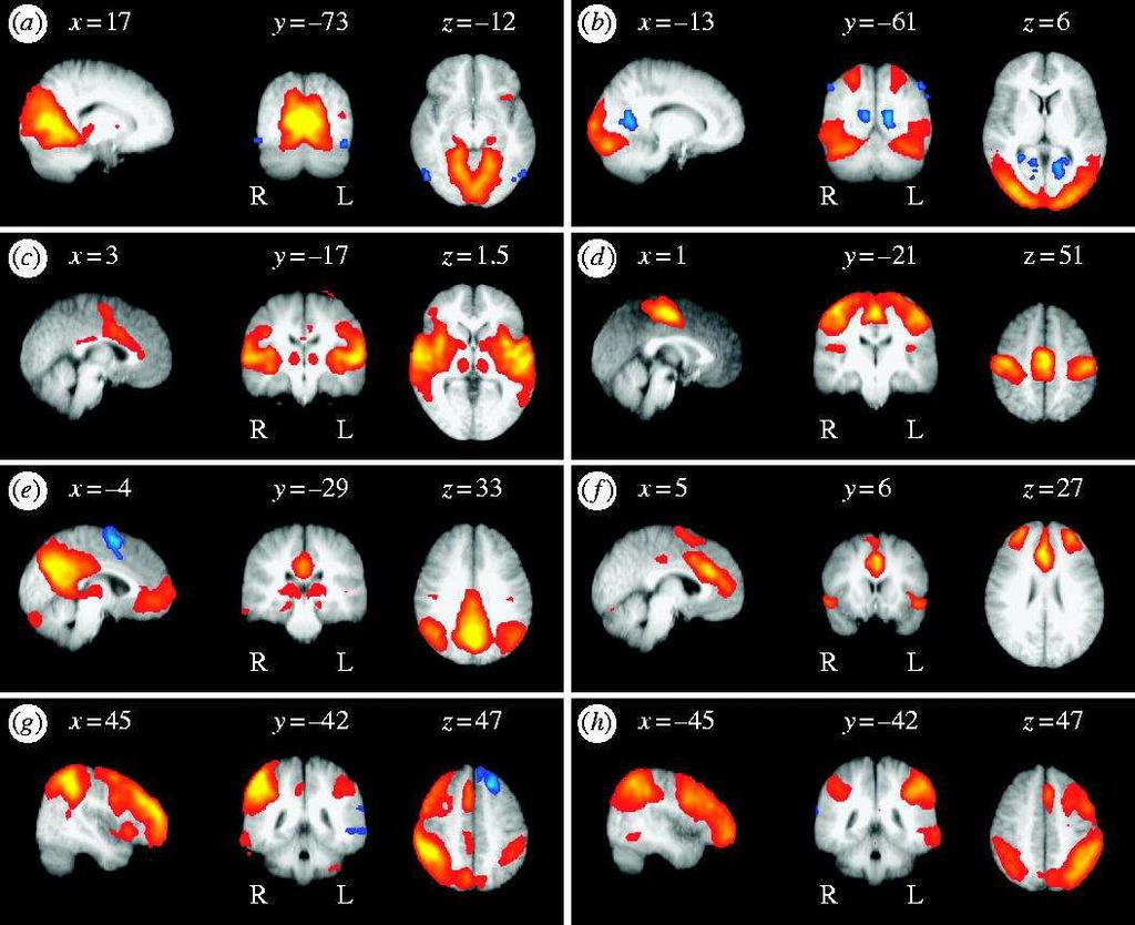 The brain at rest Independent Component Analysis of fmri at rest Issues in ICA of EEG/MEG Different sparsities Fourier-ICA Spatial ICA ICA finds resting-state networks in fmri a) Medial and b)