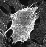 mammary carcinoma cells NIH-3T3 fibroblasts Axons