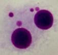 Example of DNA damage studies Micronuclei induction in cytokinesis-blocked human blood lymphocytes The micronuclei