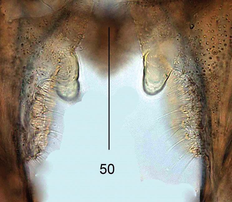 Figure 6. Pseudosmittia fabioi sp. n., male. Inferior volsella. Figure 8. Pseudosmittia fabioi sp. n., female. Antenna. Figure 7. Pseudosmittia fabioi sp. n., male. Gonostylus. Figure 9.