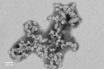 Chapitre III: Osteotropic PBLG-b-PGlu nanoparticles for cisplatin delivery 3.