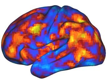 Spontaneous fluctuations in the fmri BOLD signal exhibit consistent anatomical patterns, with