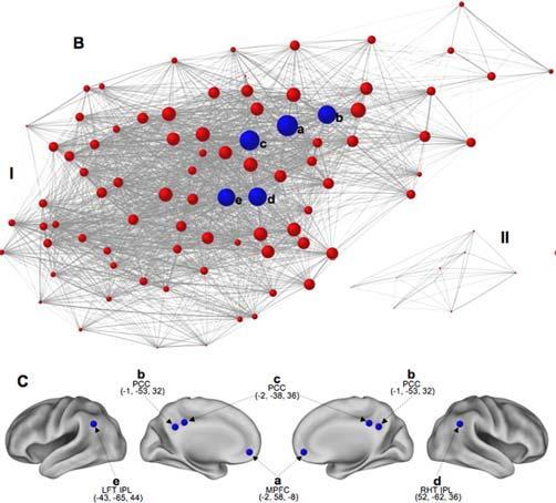 interconnected hub regions. Achard et al. (2006) J. Neurosci.