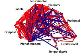 Structural, Functional, Effective Anatomical (Structural) Connectivity: Pattern of