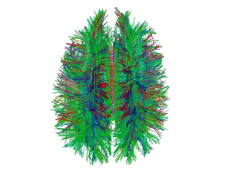 Mapping Human Brain