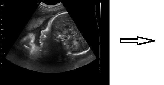 From ultrasonography to ultrafast ultrasonography Filippo, 17 Errico et.