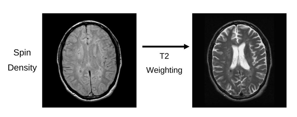 T 1 and T 2 weighting Figure 14 : T 1