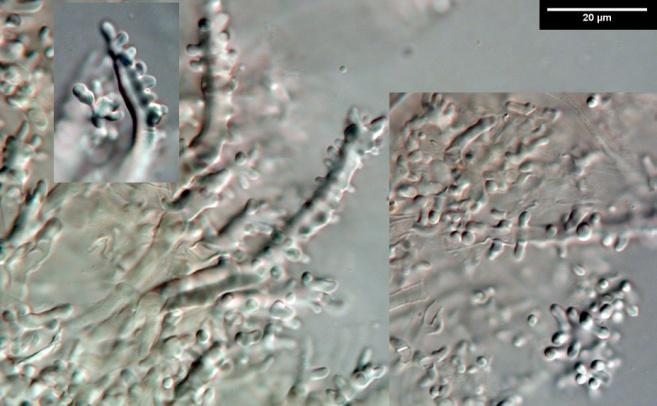 Cap hairs with pegs spores 7.2 x 5.5 Resupinatus vinosolividus can be relatively large compared to the other species treated here.