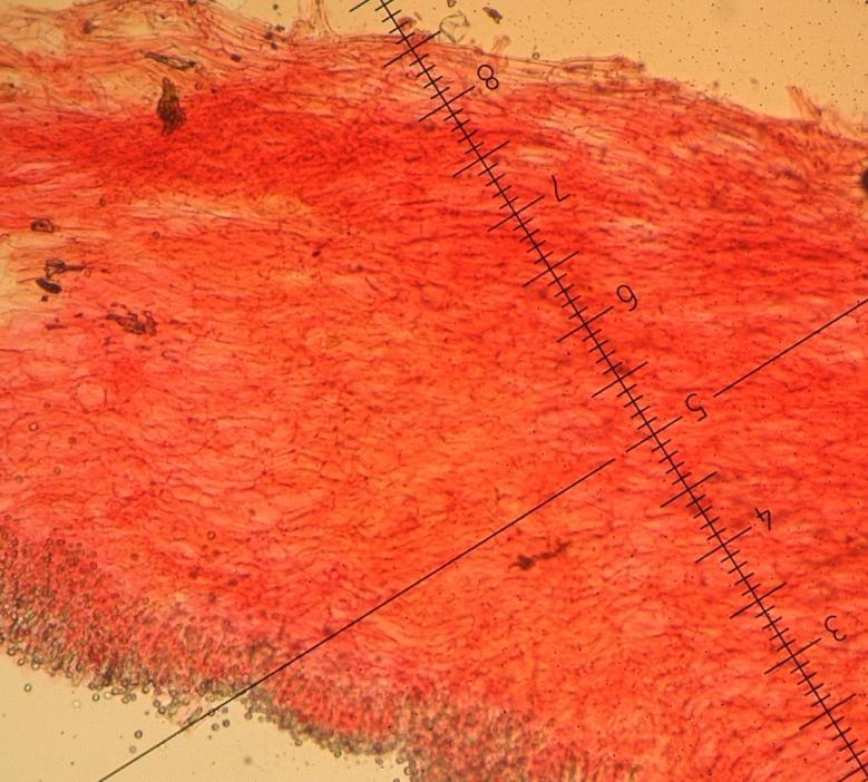 Fig. 5 Albomagister virgineus, pileus trama in congo red; graduations = 0 µm. Fig. 6 Albomagister alesandrii, collection of Oct.