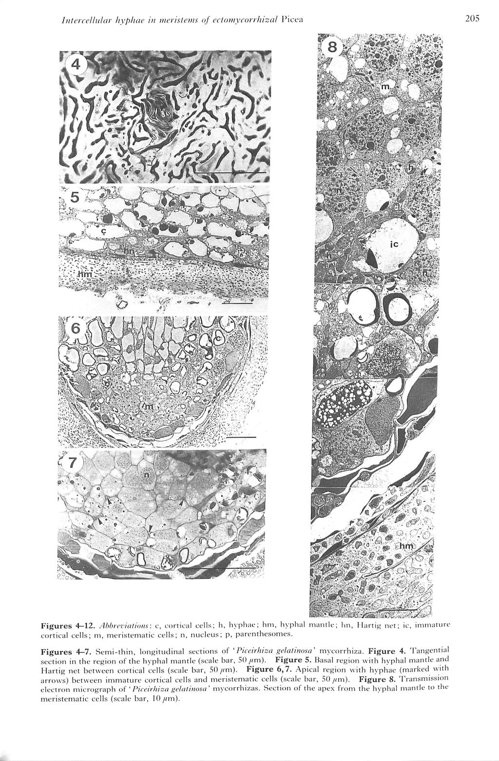 205 Ittteicellttlar hypltae i/i luerislents of eetomycorrhizal Picea ic " Figures 4-12. Abbicviatiotts: c, c()rtic;il cells; h, hypliae; hm, Inphal in.mtk cortical cell.