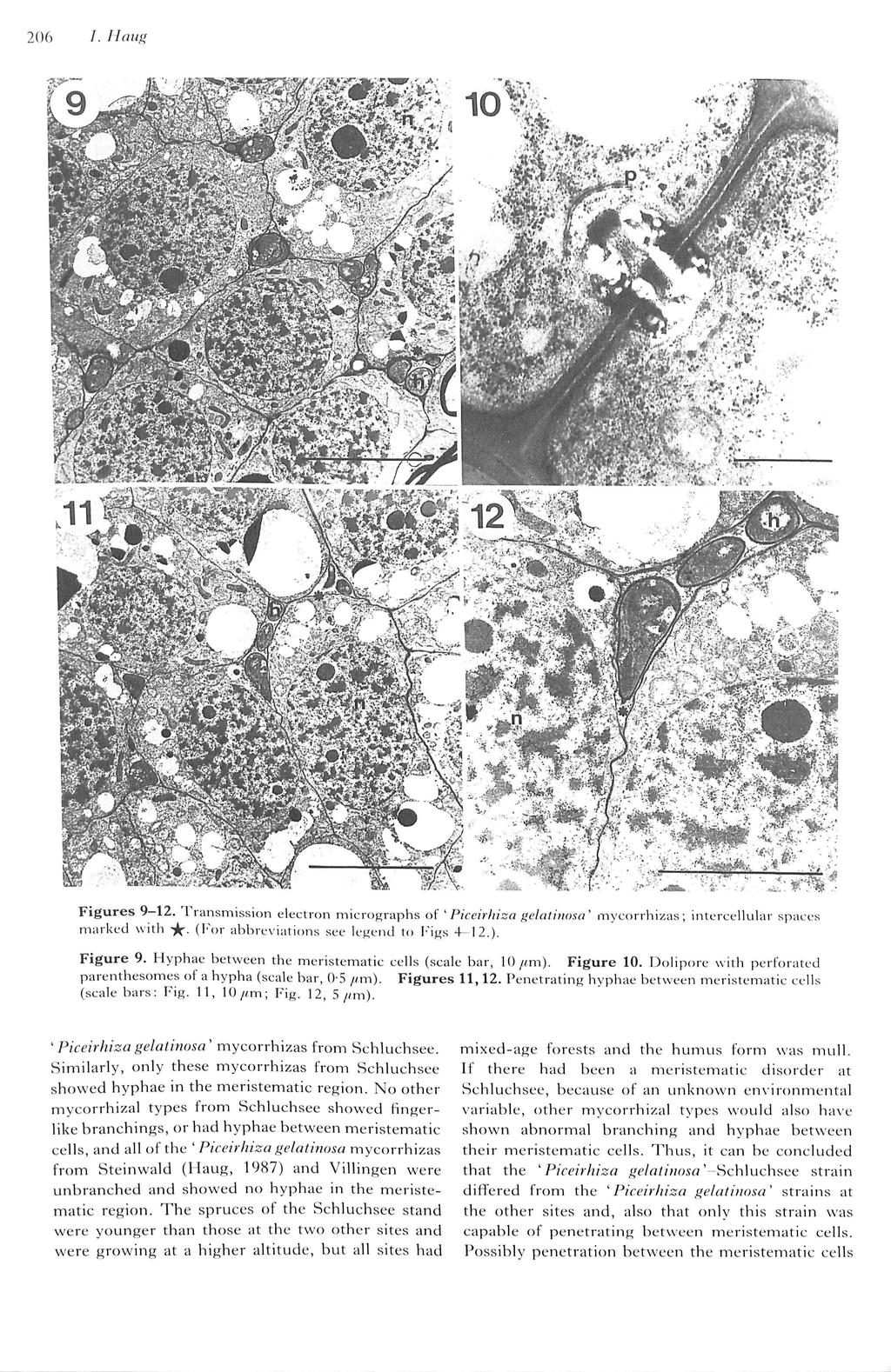 206 Figures 9-12. 1 ransmission electron micrographs of ' Piceirhiza i^ctaiiuosa' mycorrhizas; intercellular spaces marked with -^. (Vm abbreviations see lekc^nd to imfjs 4 12.). Figure 9.