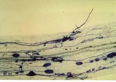 Arbuscular Mycorrhiza =endomyorrhiza Fungi belong to Glomeromycota
