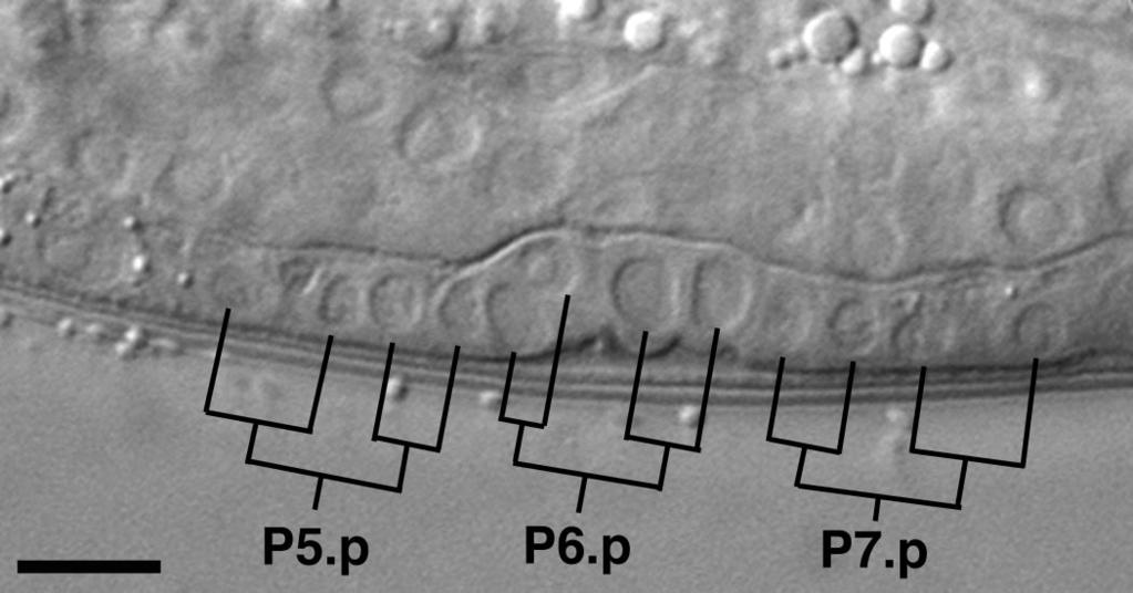 lin-4 RNA and Developmental Timing in C. elegans 93 FIG. 4. DIC image of precocious vulval development in a VT779 hermaphrodite at the L2 molt. Vulval precursor cells P5.p, P6.p, and P7.