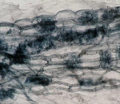 Mycorrhiza in the root