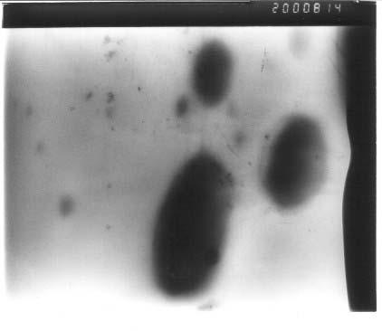 TEM image of PCL/PHB