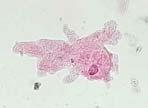 nucleus) Euglena Paramecium Amoeba Protists