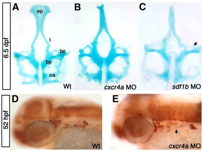 166 E.C. Olesnicky Killian et al. / Developmental Biology 333 (2009) 161 172 X are often reduced or missing in cxcr4a morphants (Figs. 3D, E; arrow).
