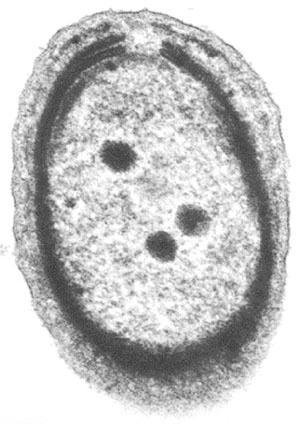 Polyhedral Bodies Prochlorococcus marinus