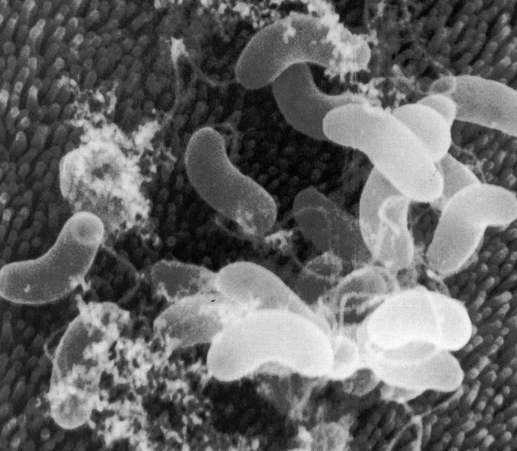 Pathogenicity V.cholerae in the small intestine Major pathogenicity determinant is TCPthe toxin co-regulated pilus.