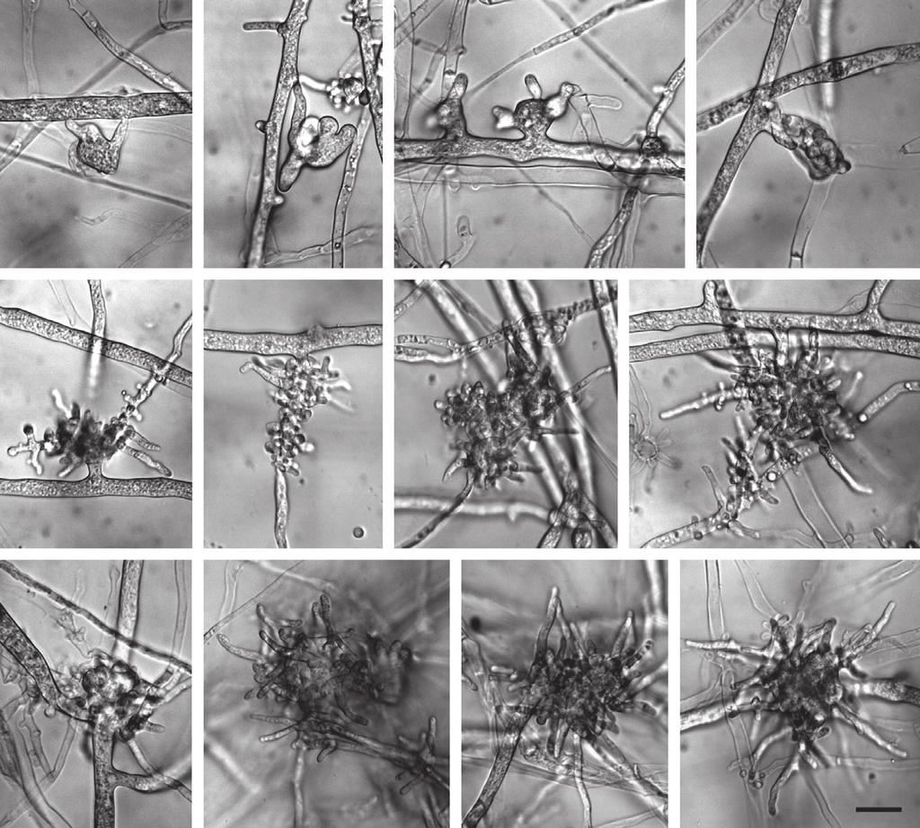 B. Ginetti et al. (a) (b) (c) (d) (e) (f) (g) (h) (i) (j) (k) (l) Figure Vegetative structures formed by Phytophthora acerina in V juice agar.