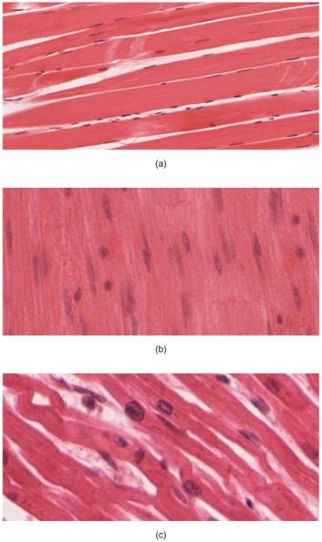 Types of Tissues Muscle Tissue: contain sheets or bundles of muscle cels that