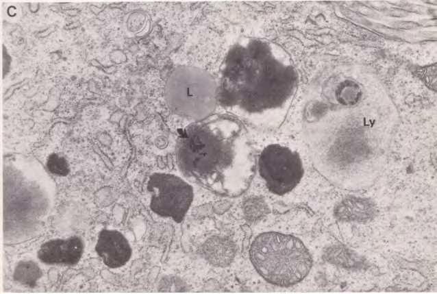 x 29 000 (b) occurrence of Cu, P, S and Ag in the fine granular material of a lysosome (Ly), (Lb) basal lamina, (Mv) microvilli, (V) vacuole. x 19 000 (after Barka, 2007).