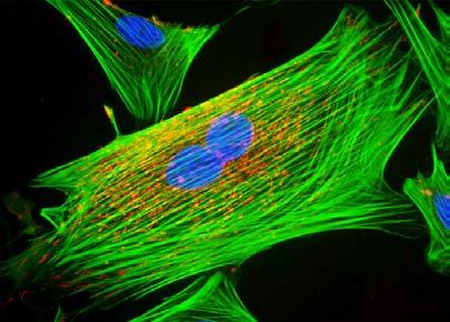 Actin: a cytoskeletal protein Actin is a biological polymer present in all eukaryotic cells (those with a nucleus).