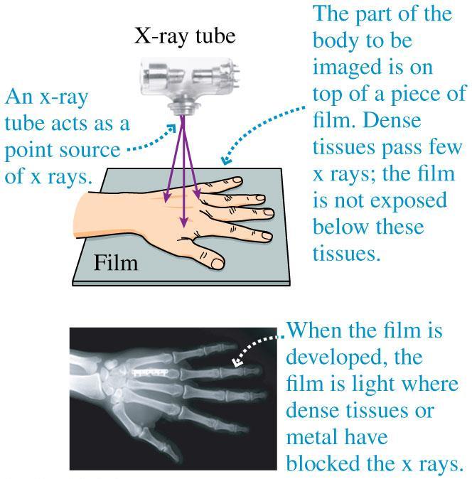 X-Ray Images Substances with high atomic numbers, such as lead or the minerals in bone, are effective at stopping x rays.