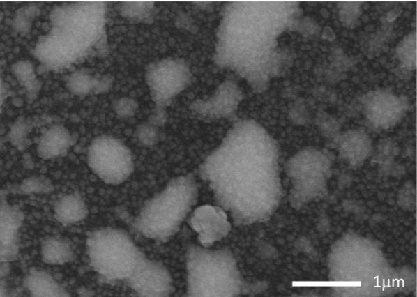 temperature dusty plasmas [18]. Figure 3. a) a-c:h nanoparticles collected at JET [14] and b) at KSTAR. A large amount of nanoparticles are agglomerated. Figure 4.