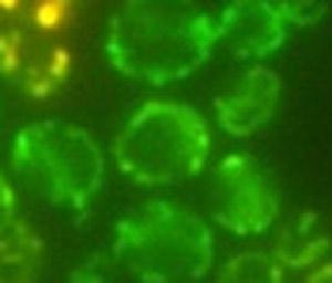 Video 1. A cell expressing Aim37-GFP that changes its localization from mitochondria to vacuole membrane when grown in H 2 O 2.