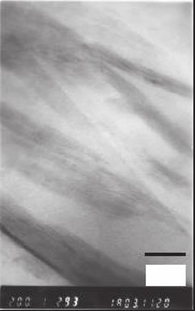 The structure of parallel alternating narrow, dark and light bands is observed in the higher magnified TEM photograph.