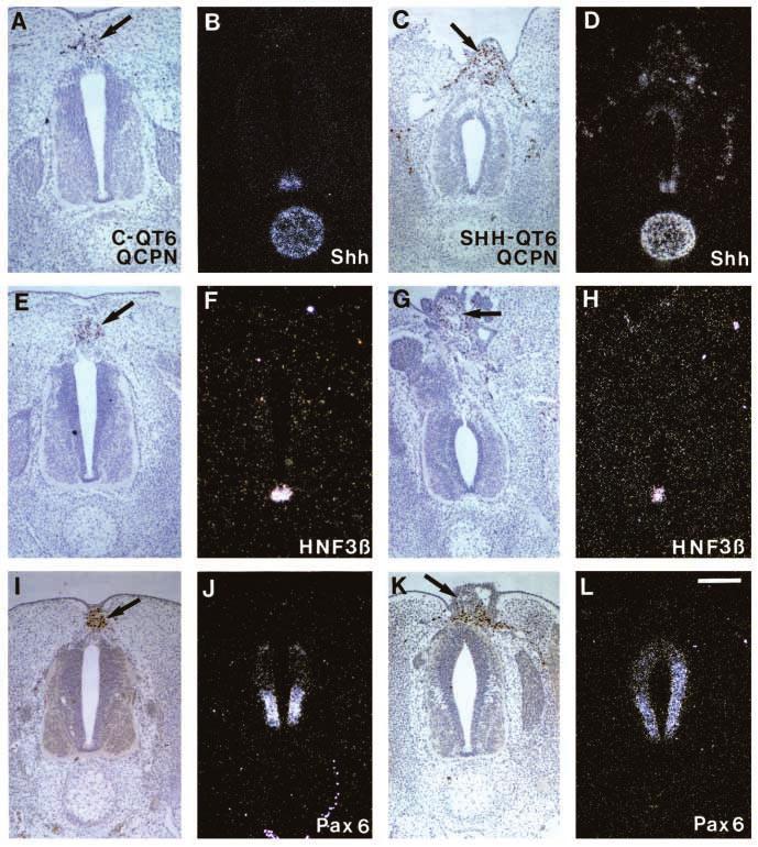 SHH and vertebra 2635 Fig. 4. Effects of dorsal grafts of SHH-QT6 cells in E5 embryos. Transverse sections where C-QT6 cells (A,B,E,F,I,J) or SHH- QT6 cells (C,D,G,H,K,L) were implanted dorsomedially.