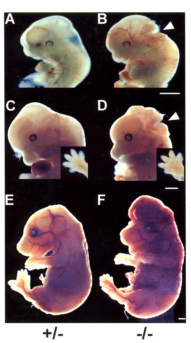 EMBRYOGENIC DEFECTS IN A MOUSE LACKING