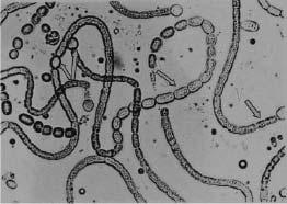 Nostoc muscorum observed under optic microscope (700x).